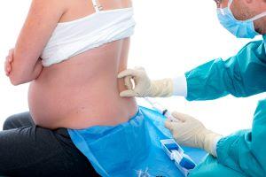 Chicago epidural injury attorney